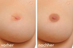 paramedizinisches parmanent make-up Uschi Lekl 4840 Vcklabruck